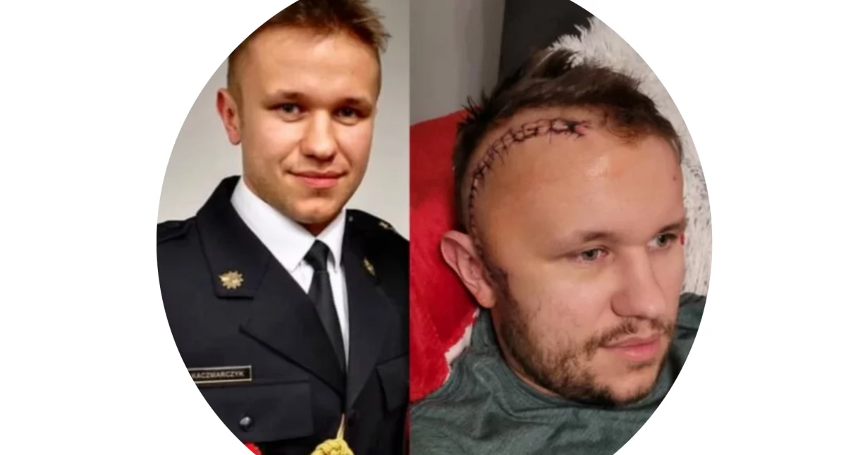 Zdjęcie: Pomoc dla strażaka z Legionowa