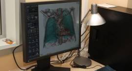 W Szpitalu Powiatowym w Zambrowie oficjalnie otwarto pracownię tomografii komputerowej